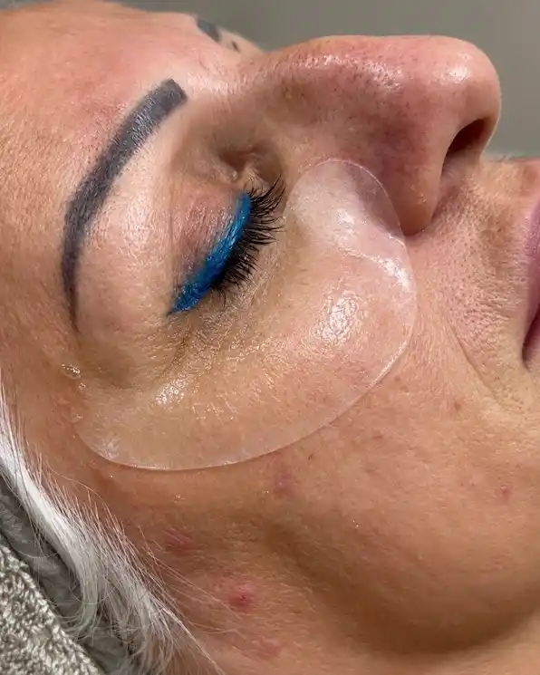 Estetica rigenerativa 